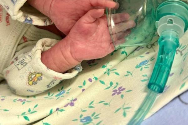 В Рязани рассказали о состоянии младенца, который родился с весом 490 грамм