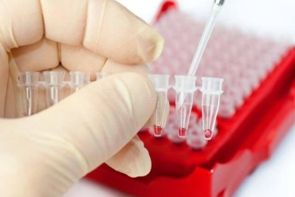 Зачем сдавать анализы на скрытые половые инфекции